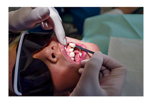 A dentist colour matches teeth colour to repair a boys chipped tooth. Melbourne, Victoria, Australia.